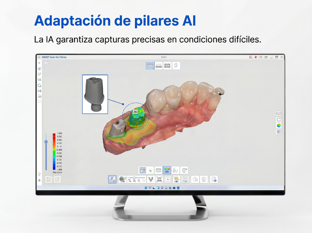 Adaptación de pilares con IA en Medit Scan for Clinics