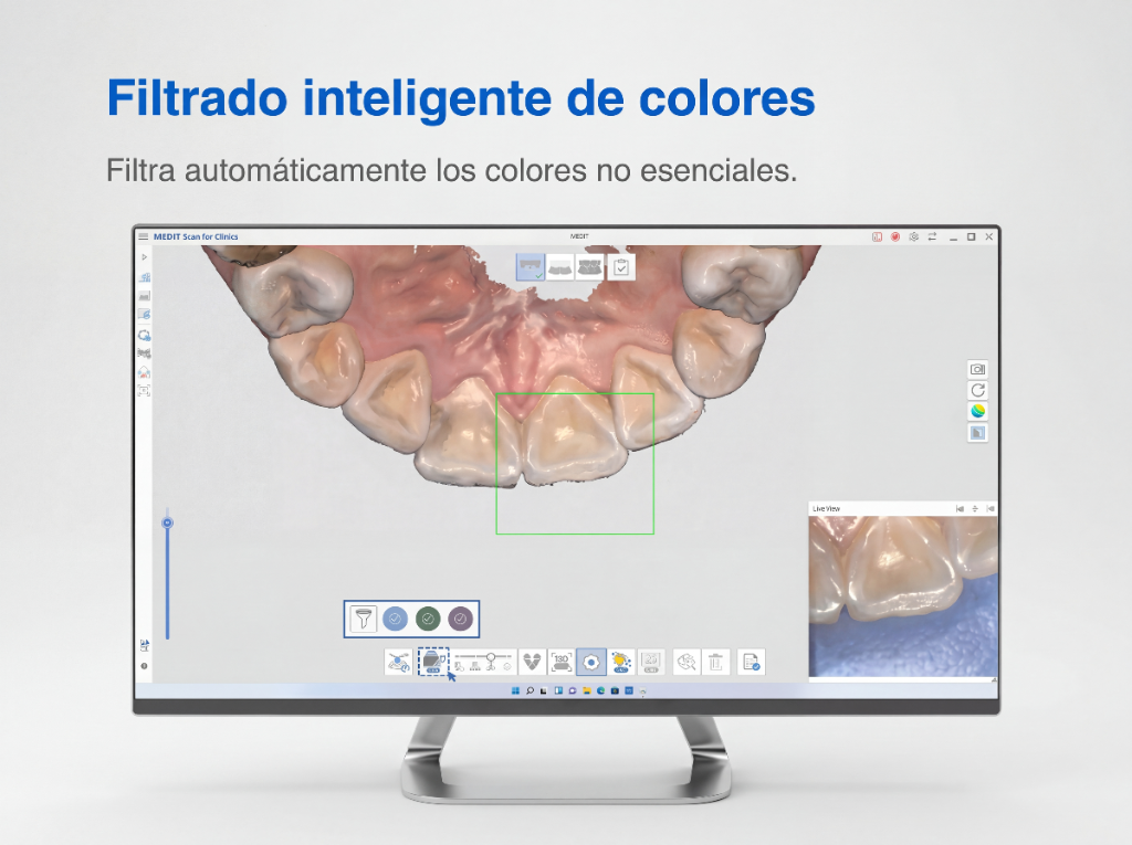 Filtrado inteligente de colores con IA en Medit Scan for Clinics